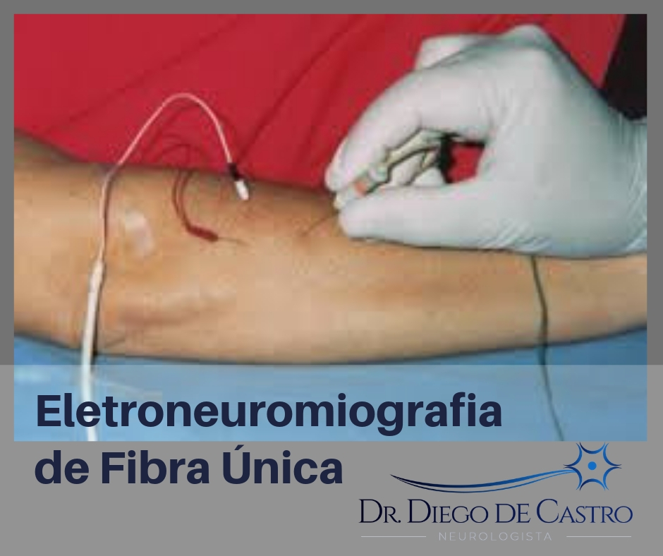 Eletroneuromiografia de Fibra Única